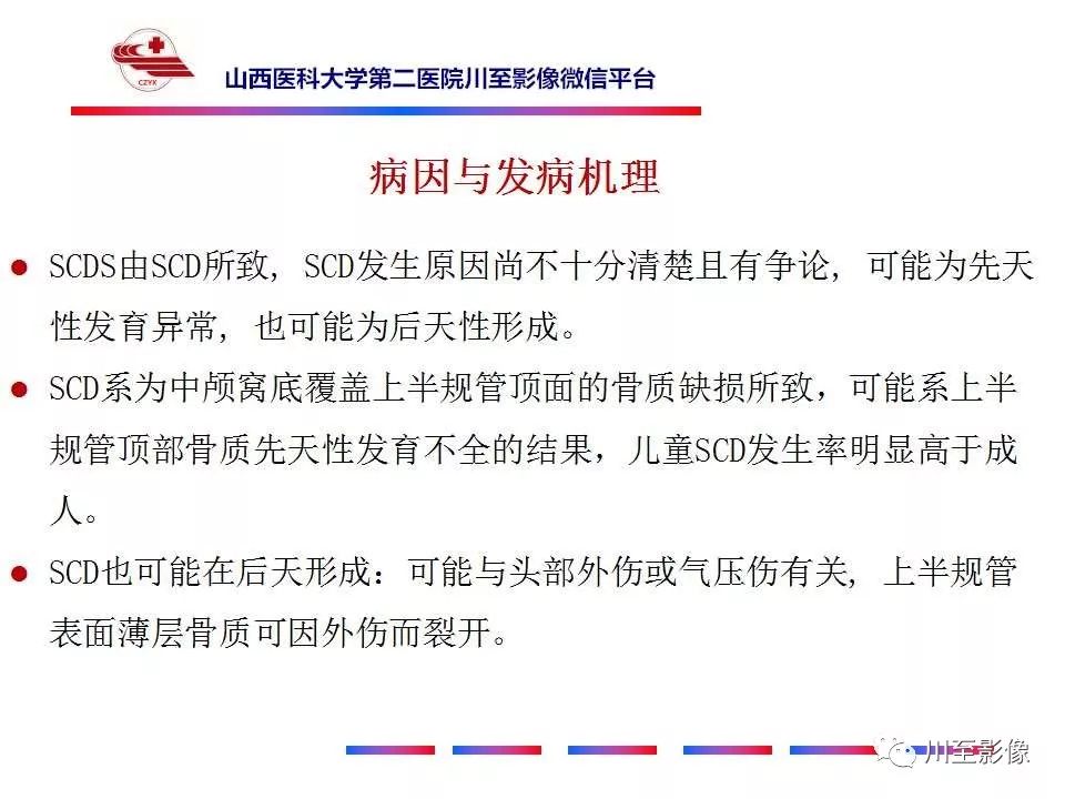 影像PPT - 【病例】上半规管裂综合征2例CT影像-16 影像PPT - 【病例】上半规管裂综合征2例CT影像-16