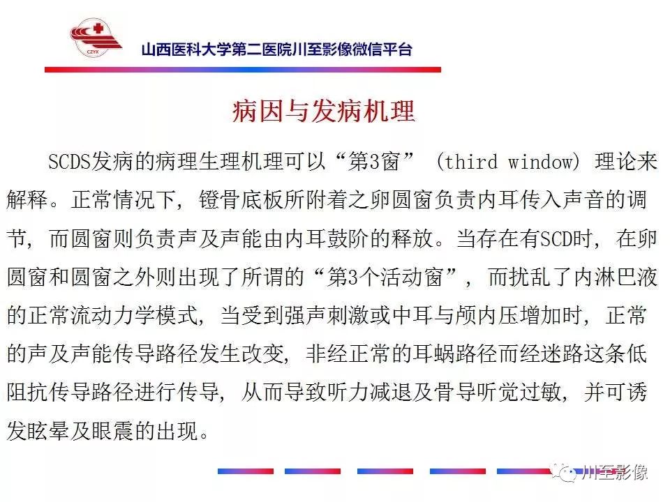 影像PPT - 【病例】上半规管裂综合征2例CT影像-17 影像PPT - 【病例】上半规管裂综合征2例CT影像-17