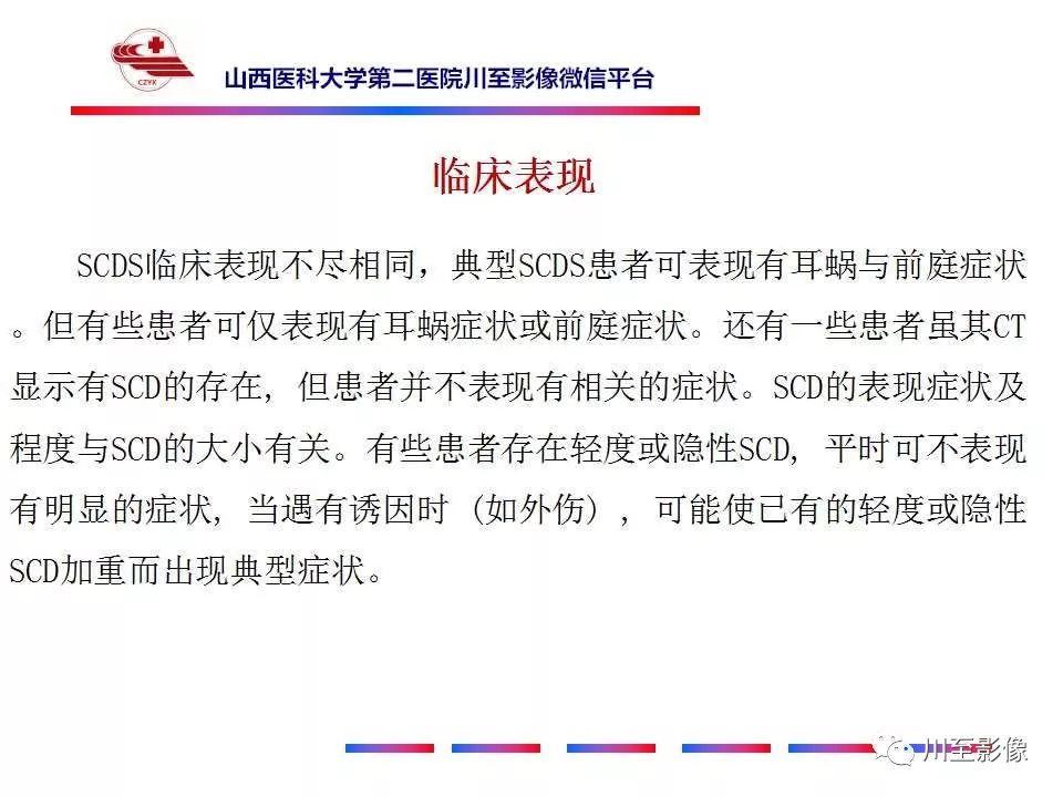 影像PPT - 【病例】上半规管裂综合征2例CT影像-18 影像PPT - 【病例】上半规管裂综合征2例CT影像-18
