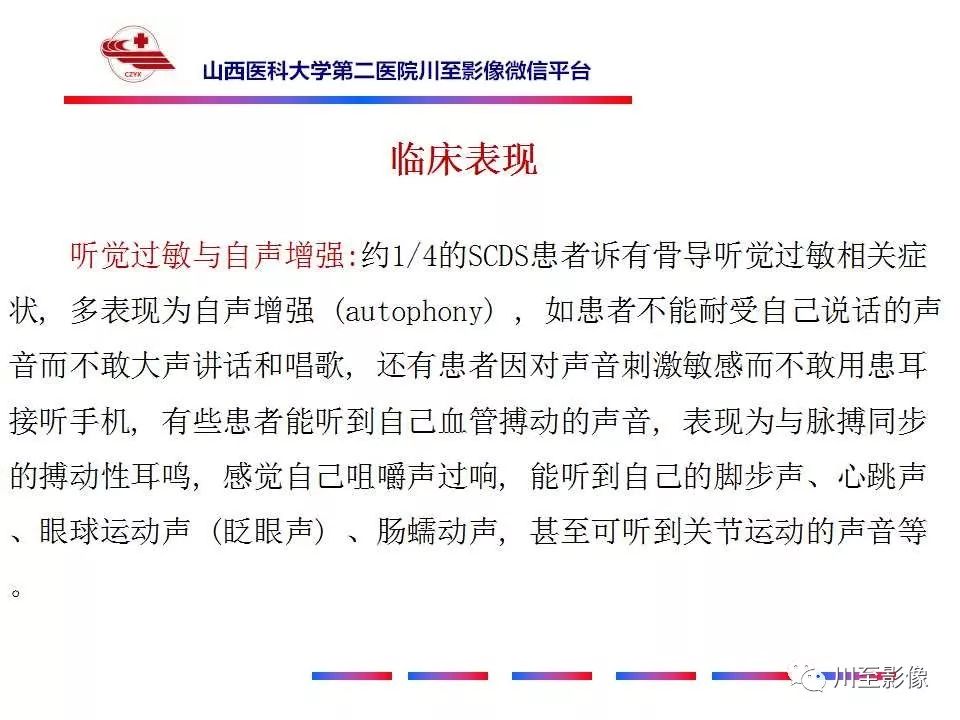 影像PPT - 【病例】上半规管裂综合征2例CT影像-19 影像PPT - 【病例】上半规管裂综合征2例CT影像-19