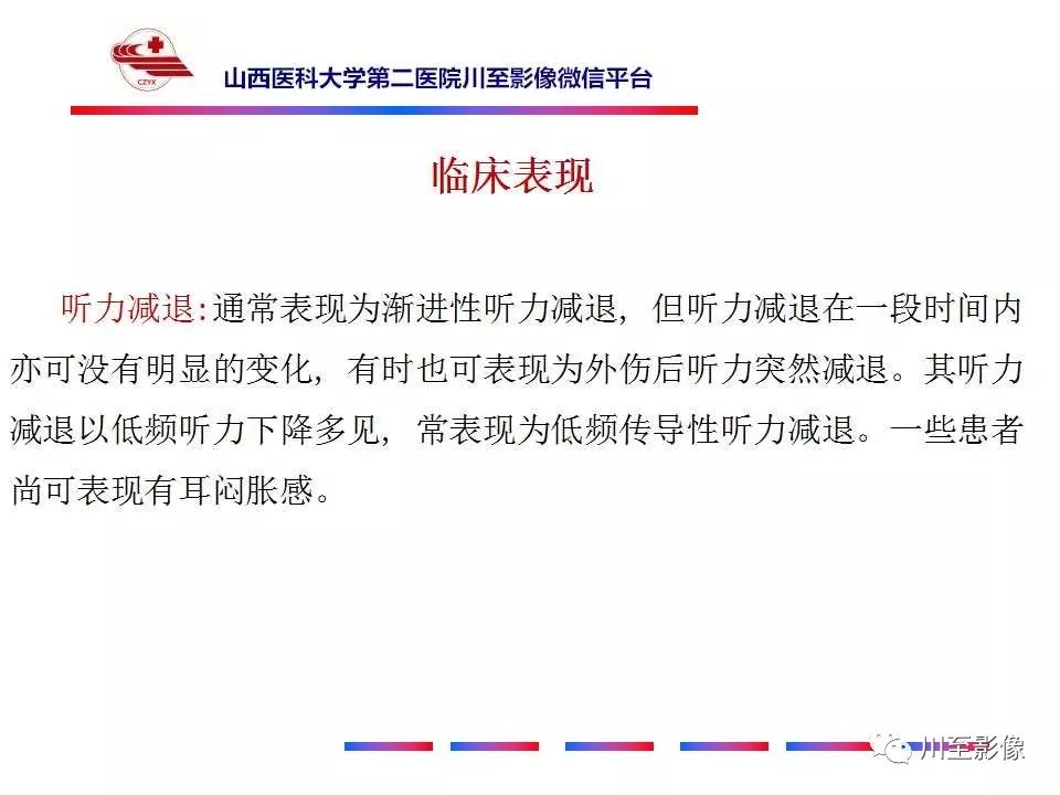影像PPT - 【病例】上半规管裂综合征2例CT影像-20 影像PPT - 【病例】上半规管裂综合征2例CT影像-20