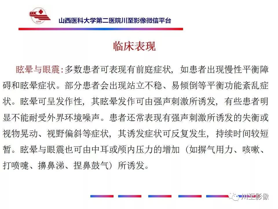 影像PPT - 【病例】上半规管裂综合征2例CT影像-21 影像PPT - 【病例】上半规管裂综合征2例CT影像-21
