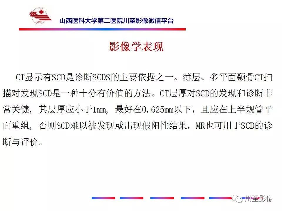 影像PPT - 【病例】上半规管裂综合征2例CT影像-22 影像PPT - 【病例】上半规管裂综合征2例CT影像-22