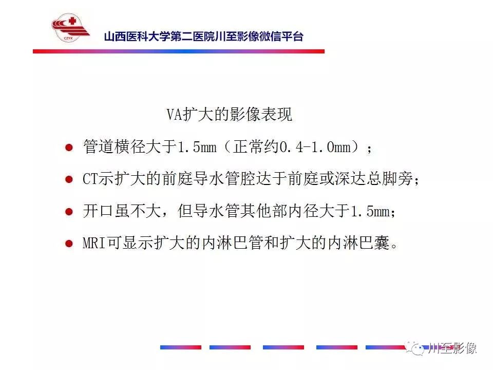 影像PPT - 【病例】上半规管裂综合征2例CT影像-29 影像PPT - 【病例】上半规管裂综合征2例CT影像-29