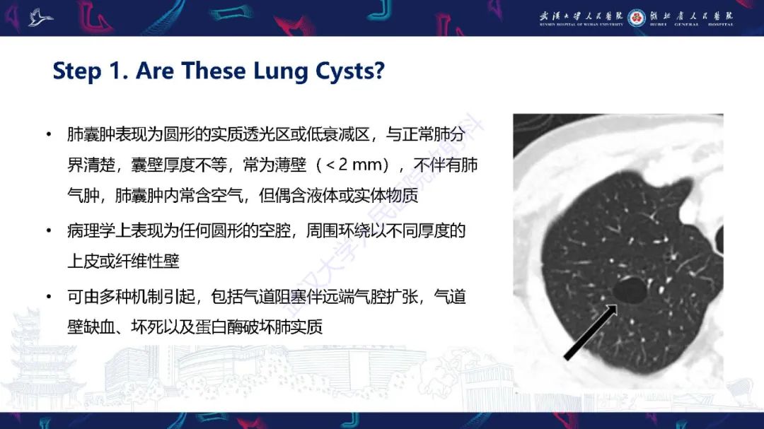 影像PPT - 【PPT】肺部囊性病变影像诊断-4