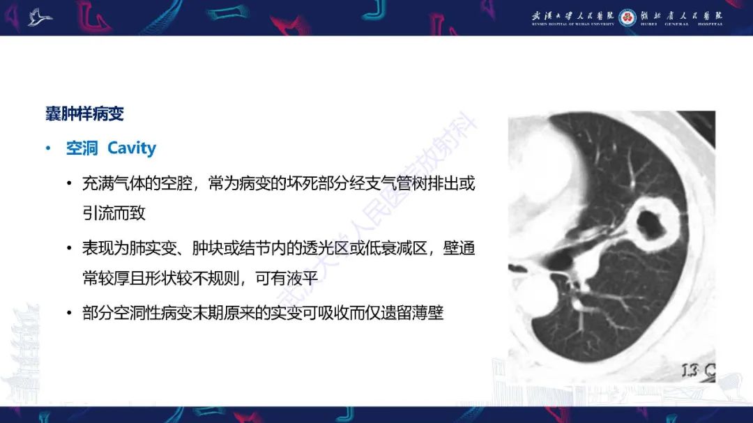 影像PPT - 【PPT】肺部囊性病变影像诊断-6
