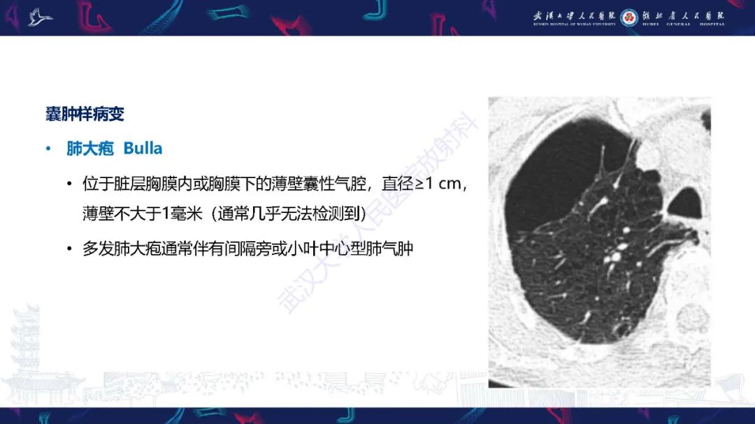 影像PPT - 【PPT】肺部囊性病变影像诊断-7