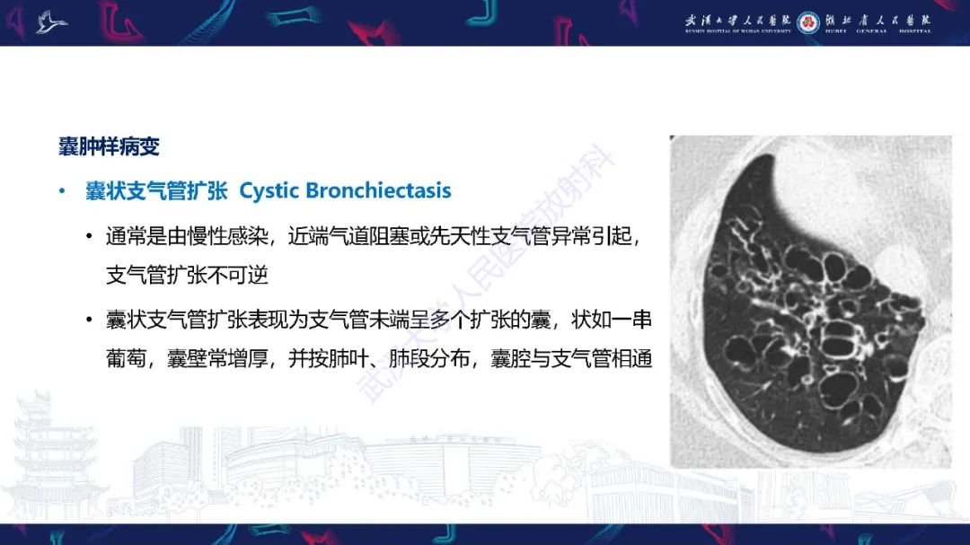 影像PPT - 【PPT】肺部囊性病变影像诊断-13