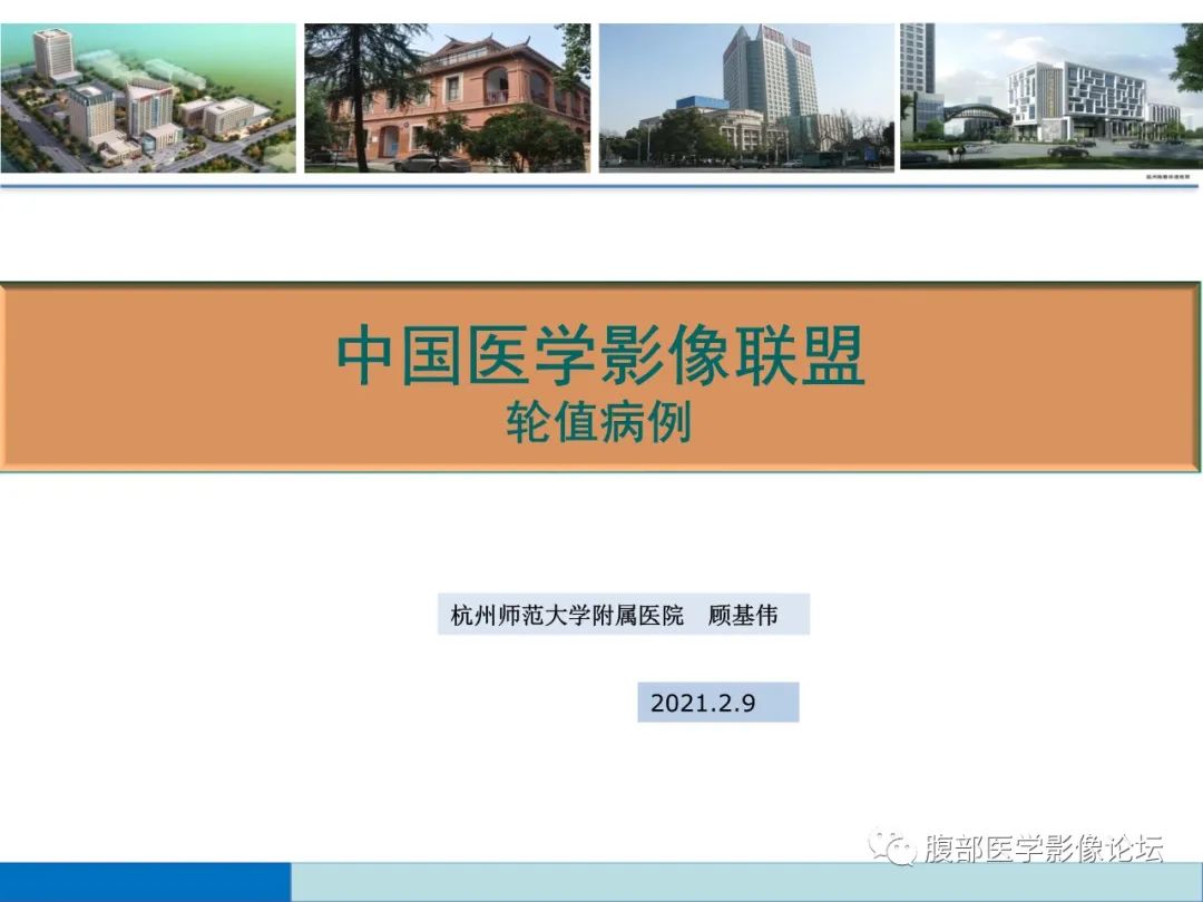 影像PPT - 【病例】脾脏淋巴瘤1例CT及MR影像讨论-1