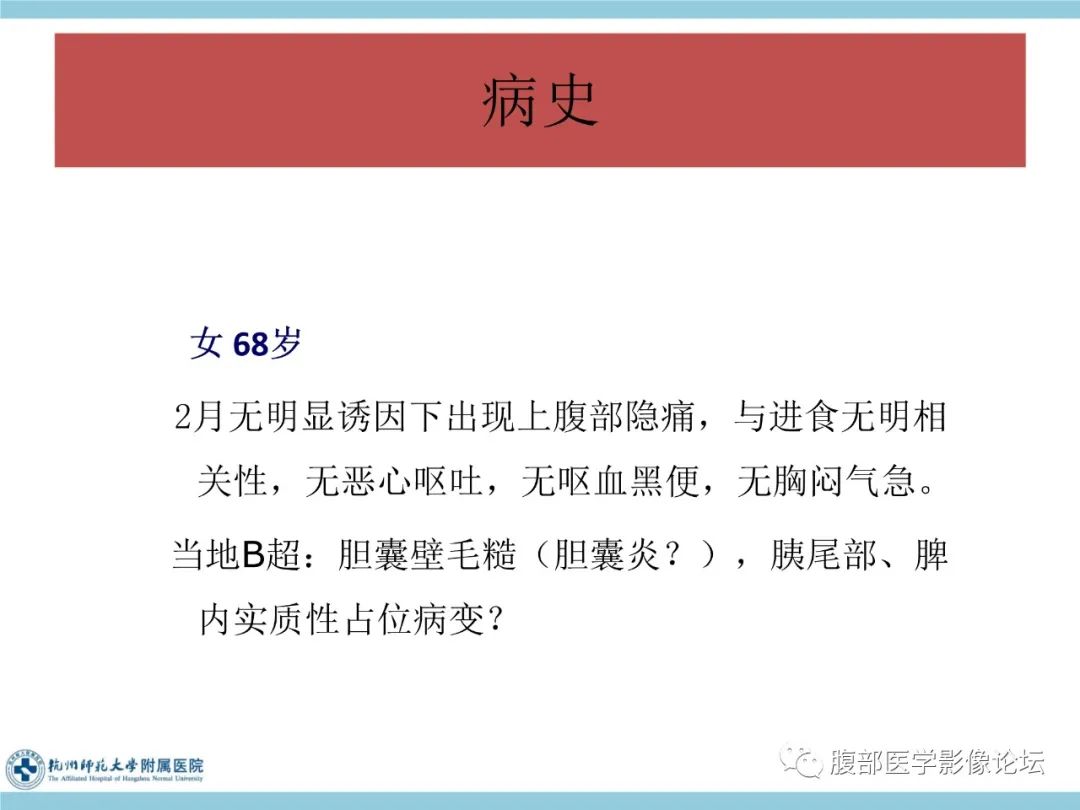 影像PPT - 【病例】脾脏淋巴瘤1例CT及MR影像讨论-2