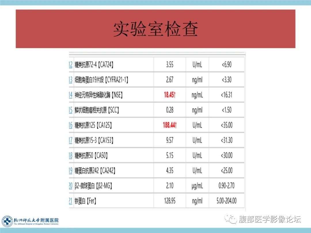 影像PPT - 【病例】脾脏淋巴瘤1例CT及MR影像讨论-3