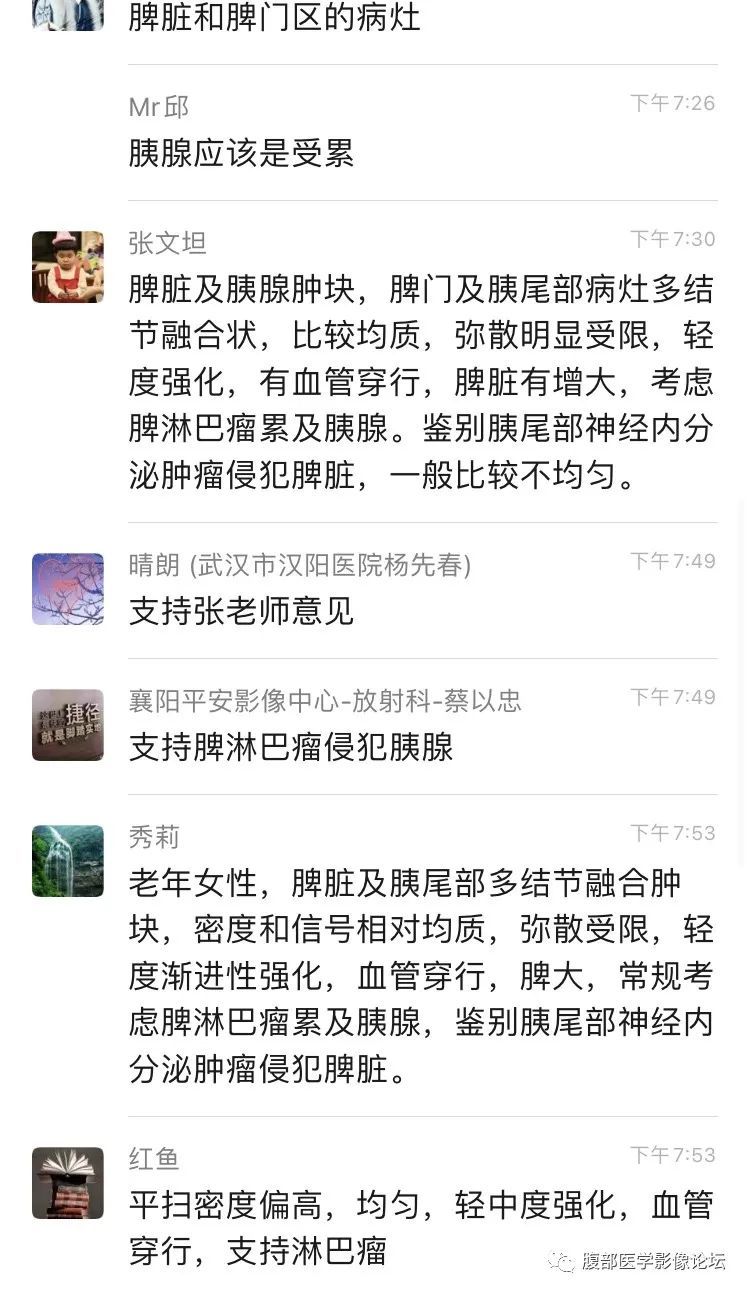 影像PPT - 【病例】脾脏淋巴瘤1例CT及MR影像讨论-22