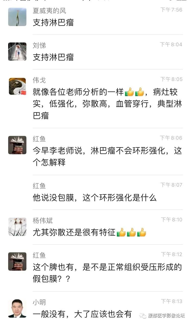 影像PPT - 【病例】脾脏淋巴瘤1例CT及MR影像讨论-23