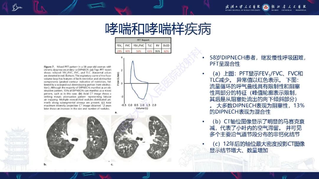 影像PPT - 【PPT】肺功能检查影像与临床-21
