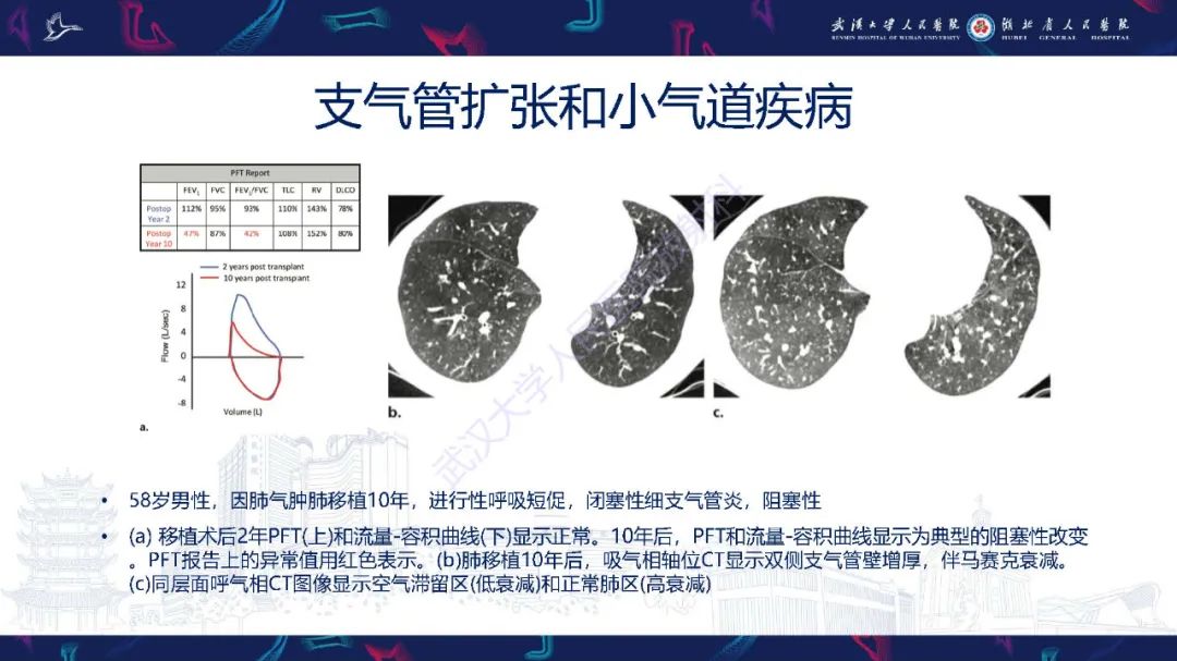 影像PPT - 【PPT】肺功能检查影像与临床-26