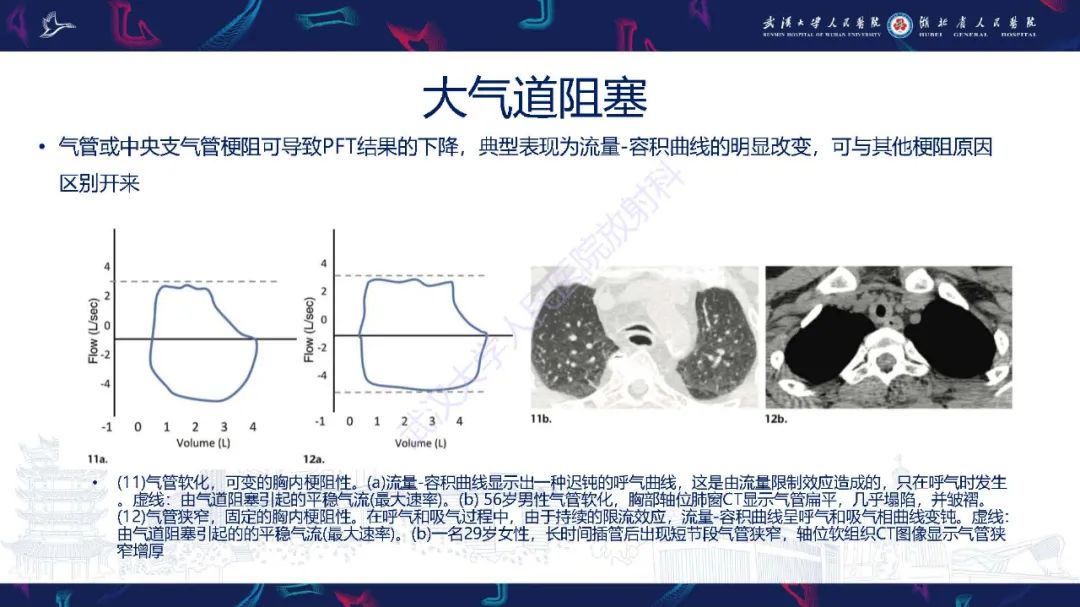 影像PPT - 【PPT】肺功能检查影像与临床-28