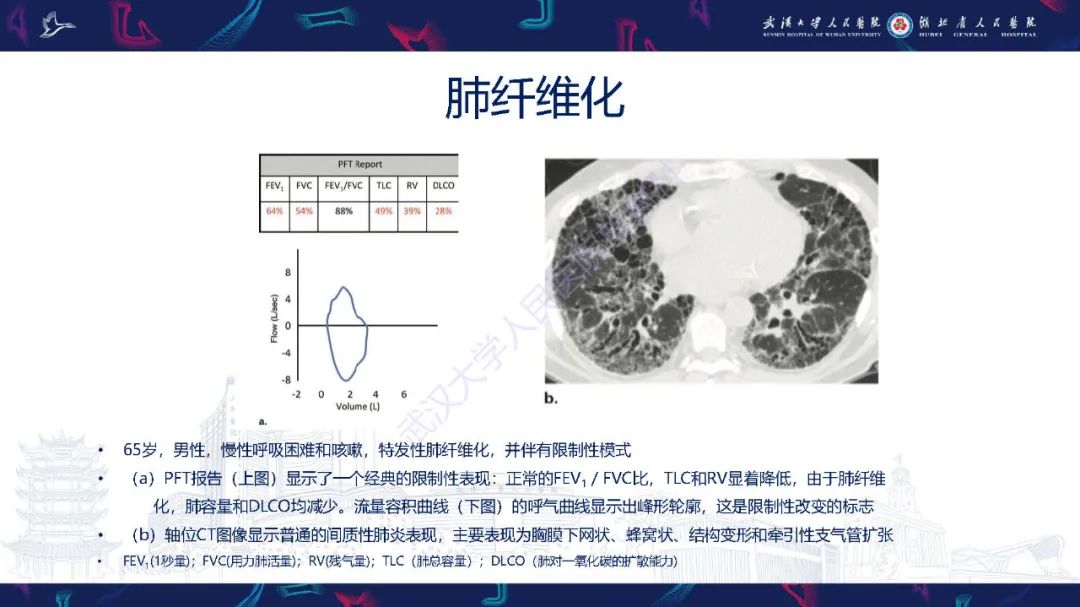 影像PPT - 【PPT】肺功能检查影像与临床-33