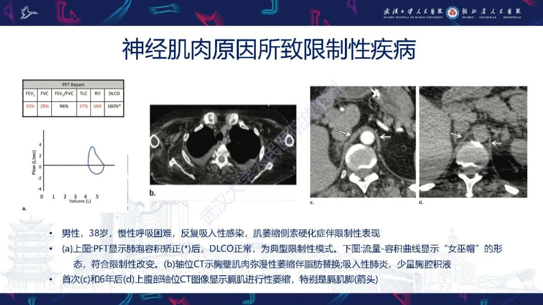 影像PPT - 【PPT】肺功能检查影像与临床-36
