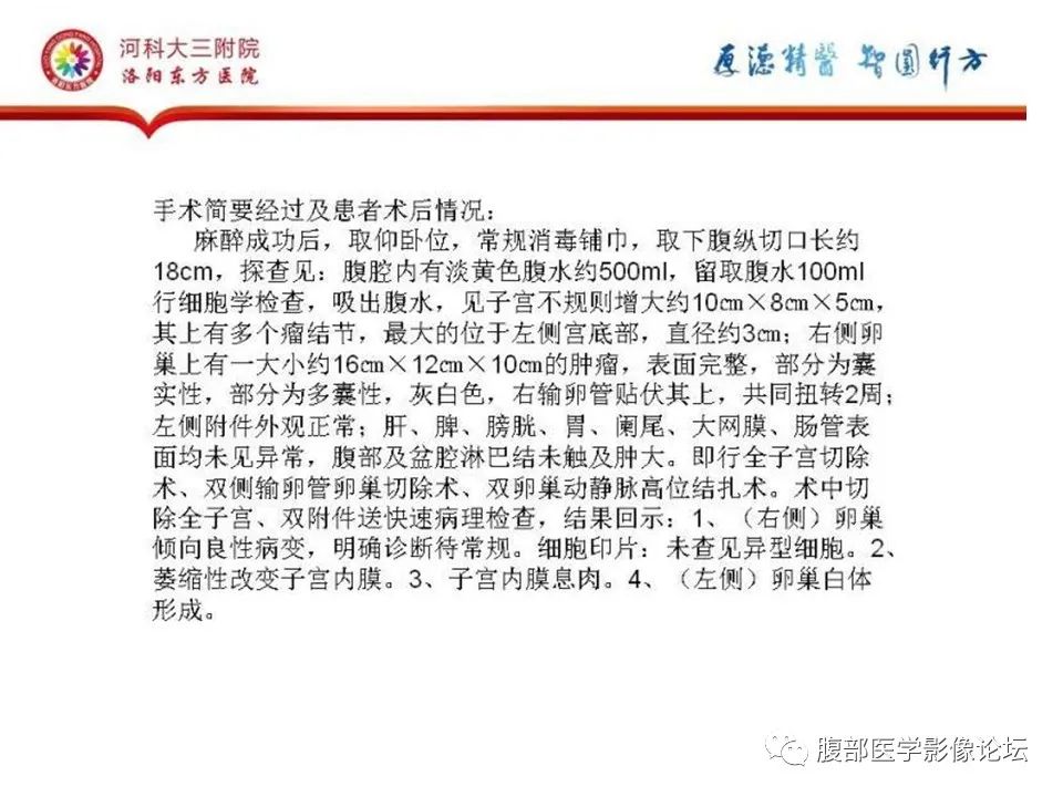 影像PPT - 【病例】卵泡膜细胞瘤1例MR影像-21
