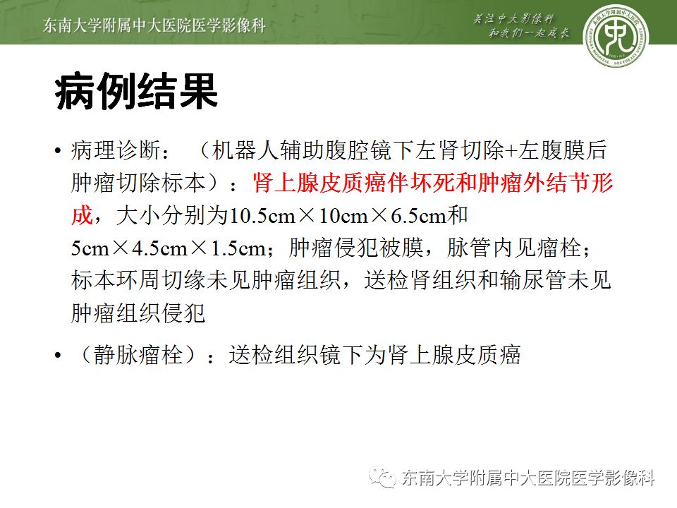 影像PPT - 【病例】肾上腺皮质癌1例CT及MR影像诊断-10