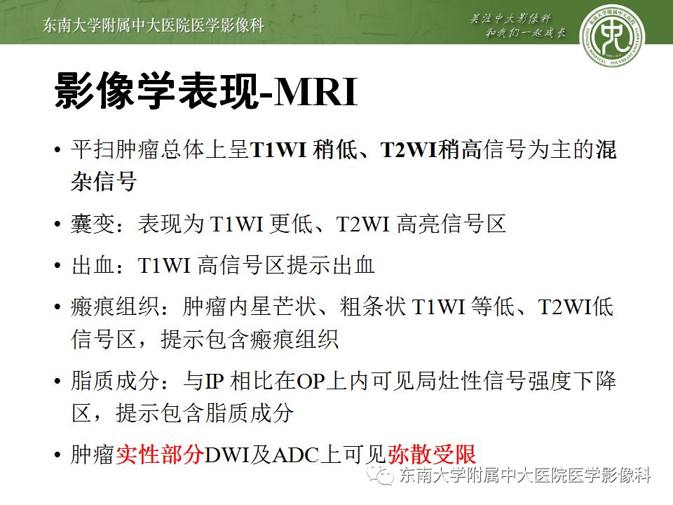 影像PPT - 【病例】肾上腺皮质癌1例CT及MR影像诊断-16