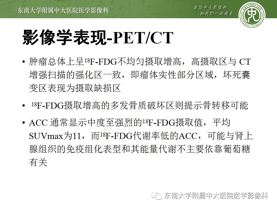 影像PPT - 【病例】肾上腺皮质癌1例CT及MR影像诊断-17