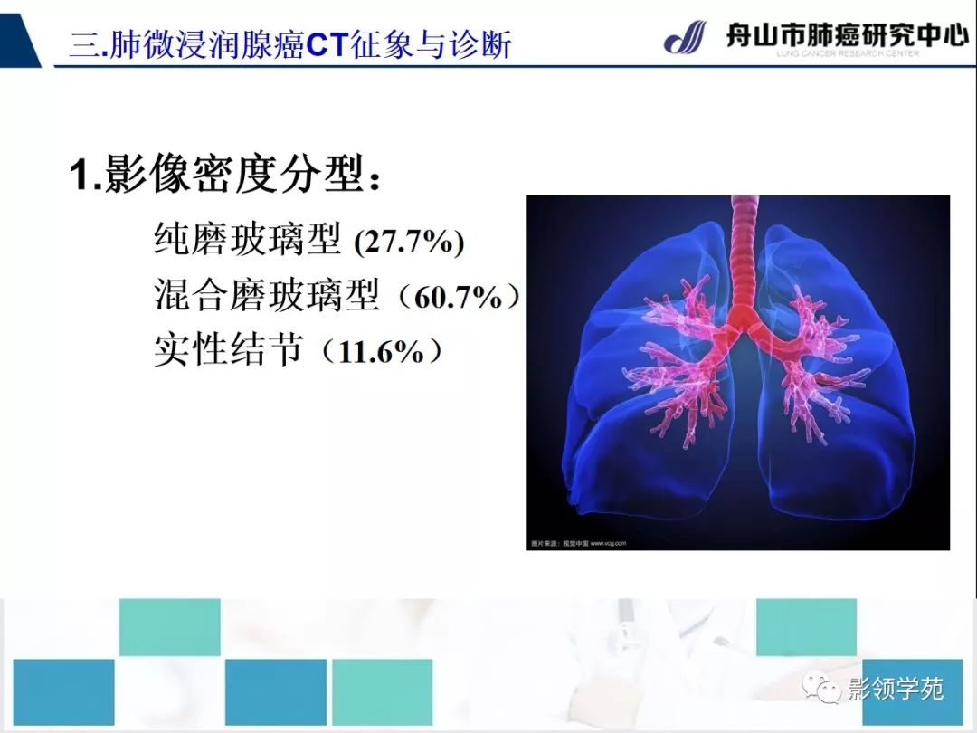 影像PPT - 【PPT】早期肺腺癌CT表现与处理策略探讨—微浸润肺腺癌-6 影像PPT - 【PPT】早期肺腺癌CT表现与处理策略探讨—微浸润肺腺癌-6