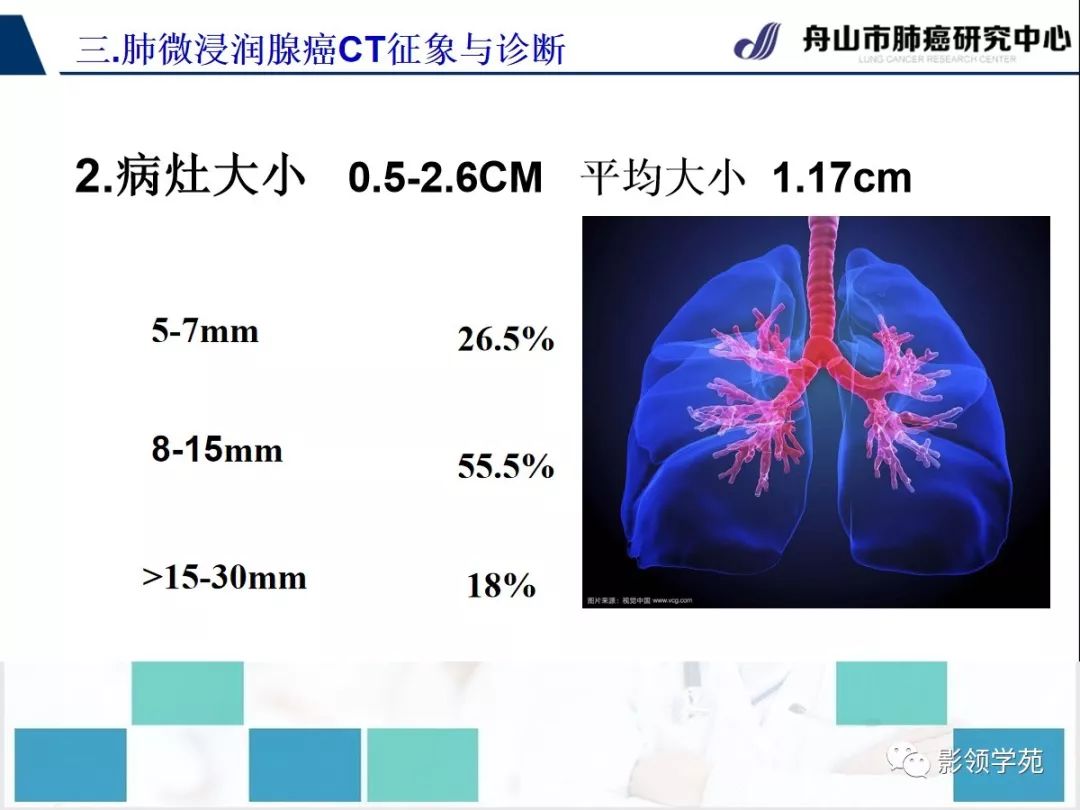 影像PPT - 【PPT】早期肺腺癌CT表现与处理策略探讨—微浸润肺腺癌-24 影像PPT - 【PPT】早期肺腺癌CT表现与处理策略探讨—微浸润肺腺癌-24