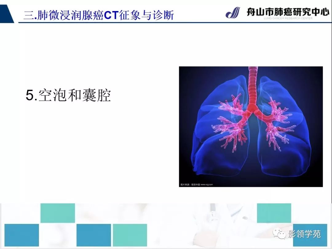 影像PPT - 【PPT】早期肺腺癌CT表现与处理策略探讨—微浸润肺腺癌-38 影像PPT - 【PPT】早期肺腺癌CT表现与处理策略探讨—微浸润肺腺癌-38
