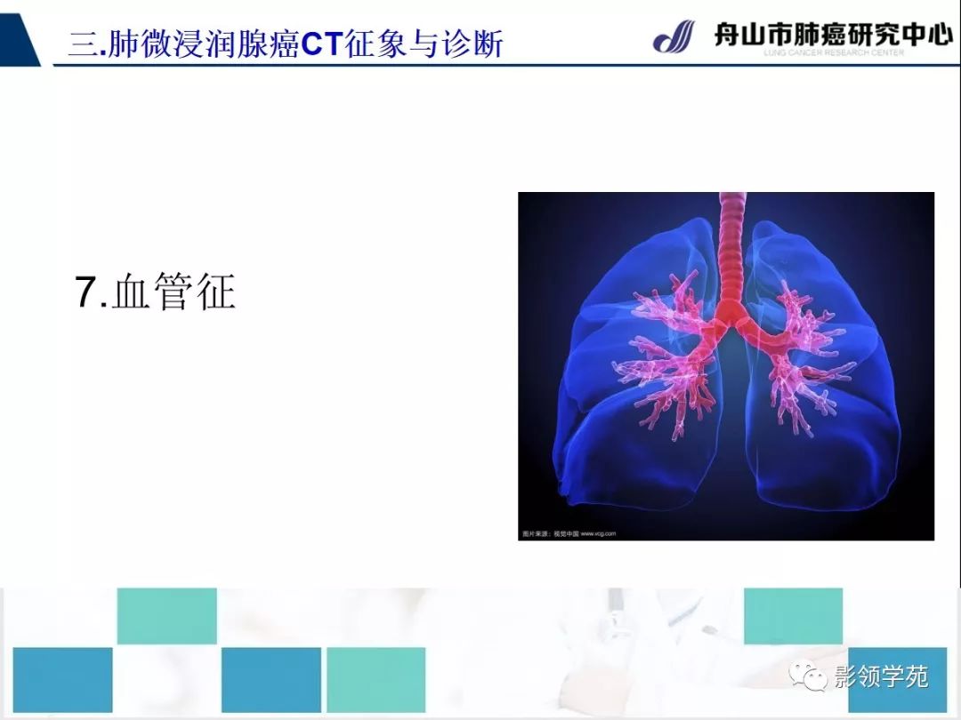 影像PPT - 【PPT】早期肺腺癌CT表现与处理策略探讨—微浸润肺腺癌-45 影像PPT - 【PPT】早期肺腺癌CT表现与处理策略探讨—微浸润肺腺癌-45
