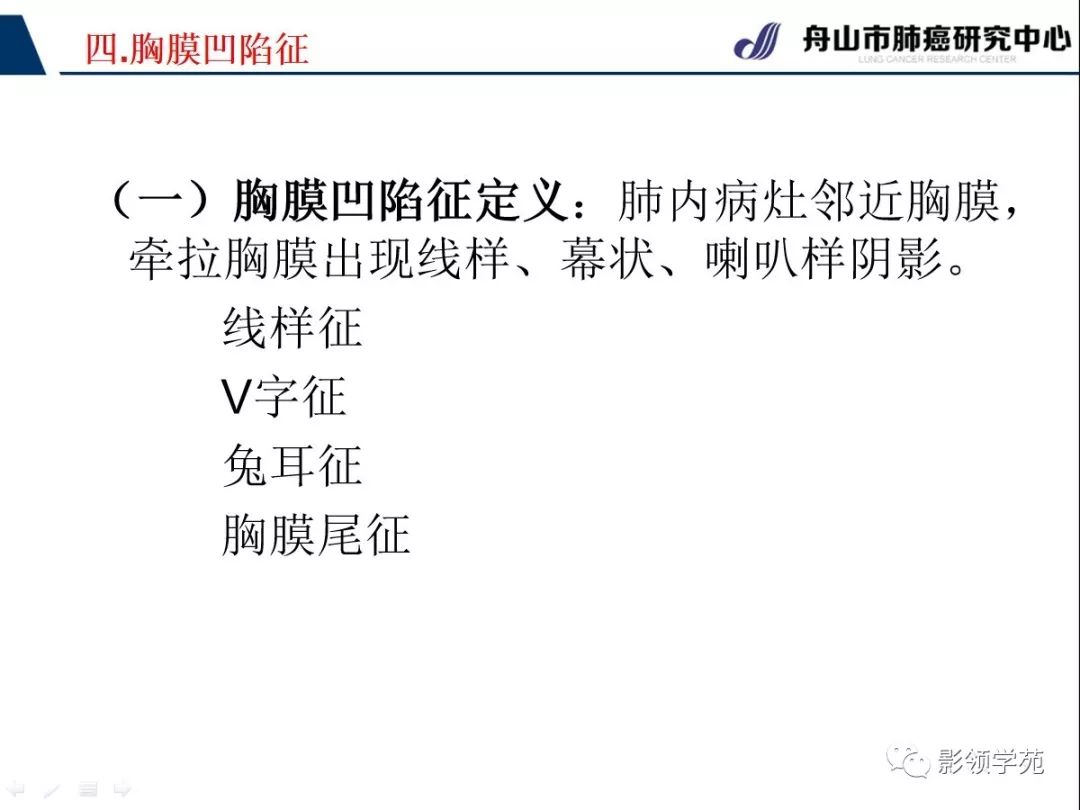 影像PPT - 【PPT】CT征象对早期肺腺癌亚型分型价值探讨—胸膜凹陷征-3 影像PPT - 【PPT】CT征象对早期肺腺癌亚型分型价值探讨—胸膜凹陷征-3
