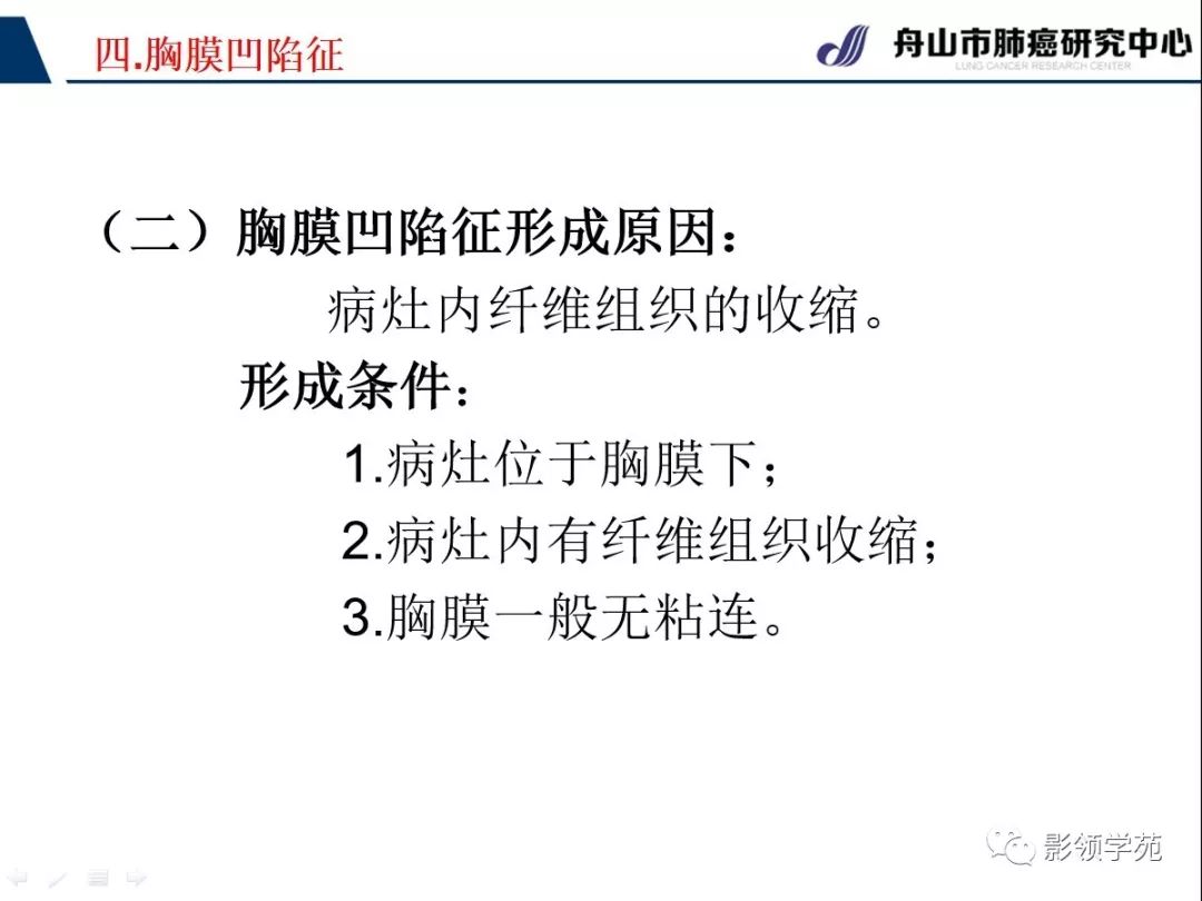 影像PPT - 【PPT】CT征象对早期肺腺癌亚型分型价值探讨—胸膜凹陷征-4 影像PPT - 【PPT】CT征象对早期肺腺癌亚型分型价值探讨—胸膜凹陷征-4