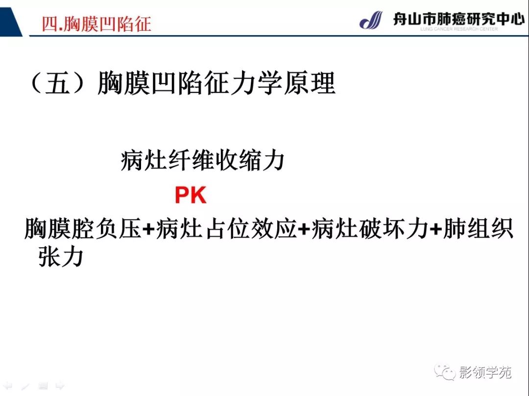 影像PPT - 【PPT】CT征象对早期肺腺癌亚型分型价值探讨—胸膜凹陷征-11 影像PPT - 【PPT】CT征象对早期肺腺癌亚型分型价值探讨—胸膜凹陷征-11