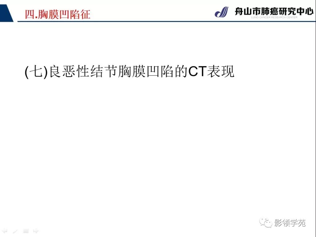 影像PPT - 【PPT】CT征象对早期肺腺癌亚型分型价值探讨—胸膜凹陷征-20 影像PPT - 【PPT】CT征象对早期肺腺癌亚型分型价值探讨—胸膜凹陷征-20
