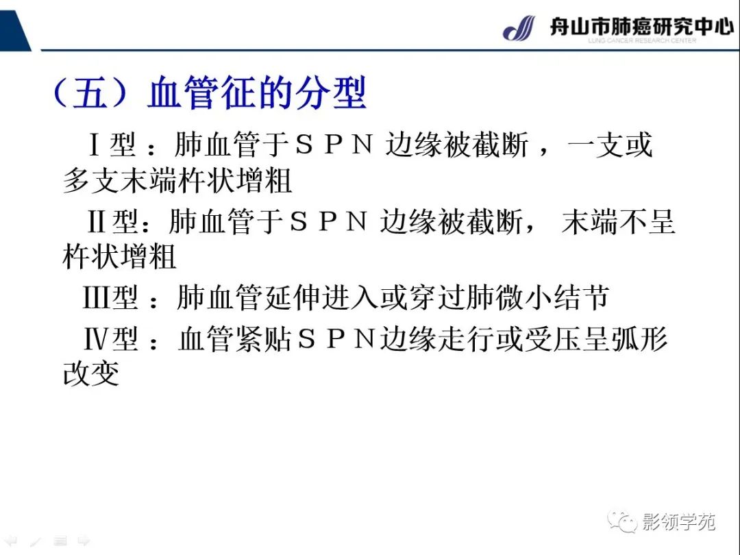 影像PPT - 【PPT】CT征象对早期肺腺癌亚型分型价值探讨—血管征-4 影像PPT - 【PPT】CT征象对早期肺腺癌亚型分型价值探讨—血管征-4