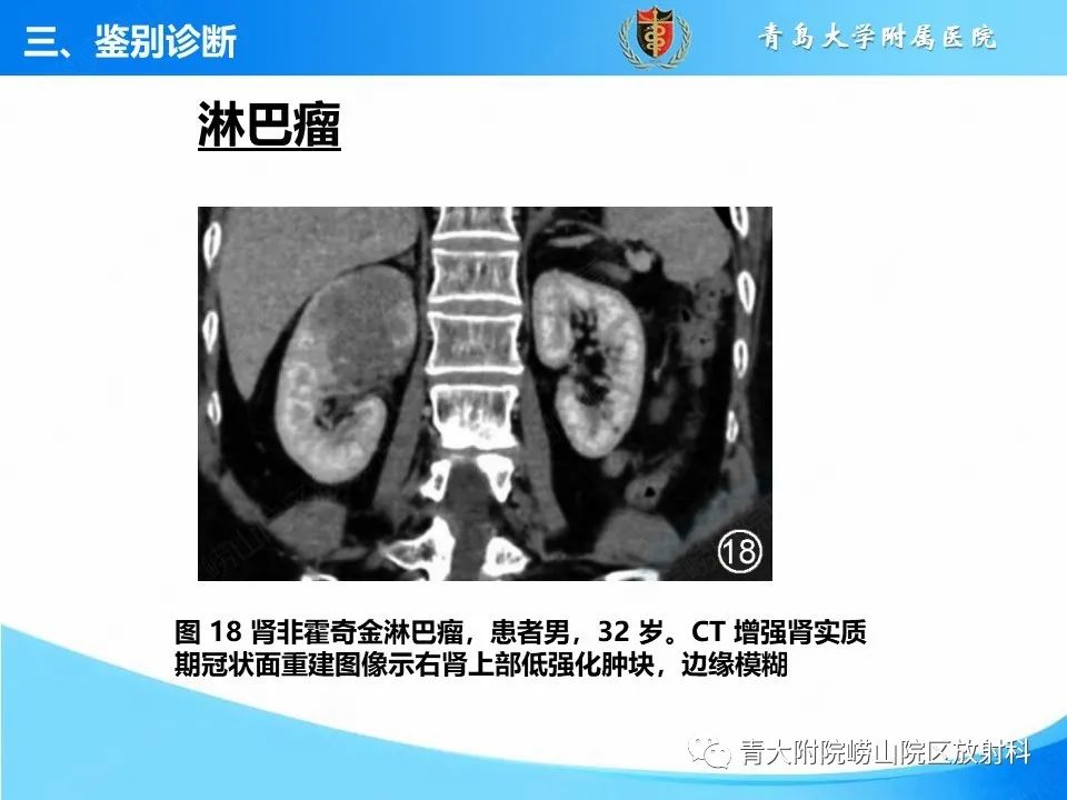 影像PPT - 【PPT】实性肾细胞癌的影像诊断与鉴别诊断-25
