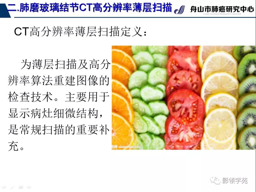 影像PPT - 【PPT】肺磨玻璃结节CT精确检查技术的临床应用-21