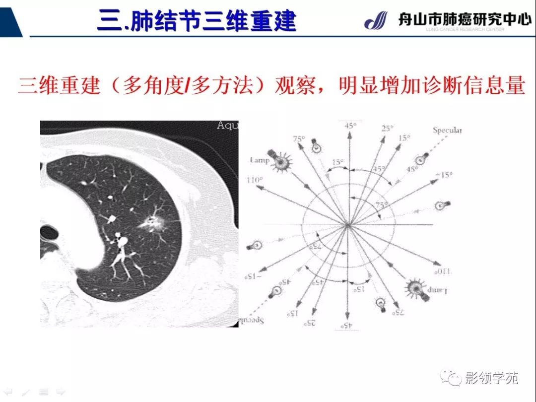 影像PPT - 【PPT】肺磨玻璃结节CT精确检查技术的临床应用-27
