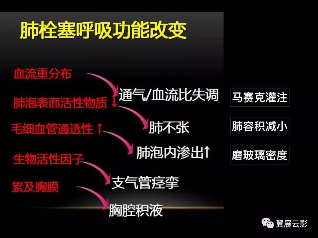 影像PPT - 【PPT】肺栓塞影像诊断与鉴别-4