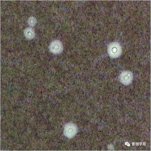 影像PPT - 隐球菌的各种不同表现-14 影像PPT - 隐球菌的各种不同表现-14