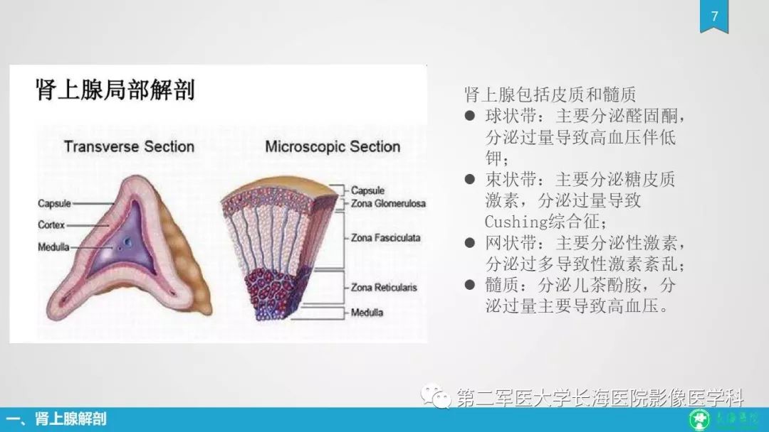 影像PPT - 【PPT】肾上腺肿物的分类及其影像学特点-7