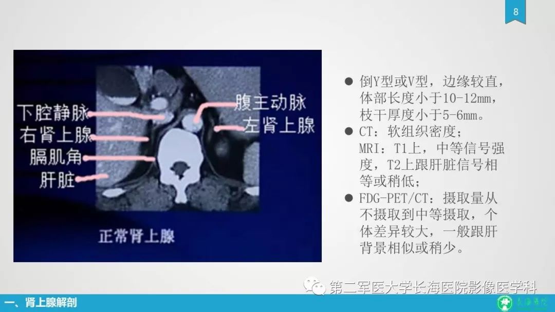 影像PPT - 【PPT】肾上腺肿物的分类及其影像学特点-8
