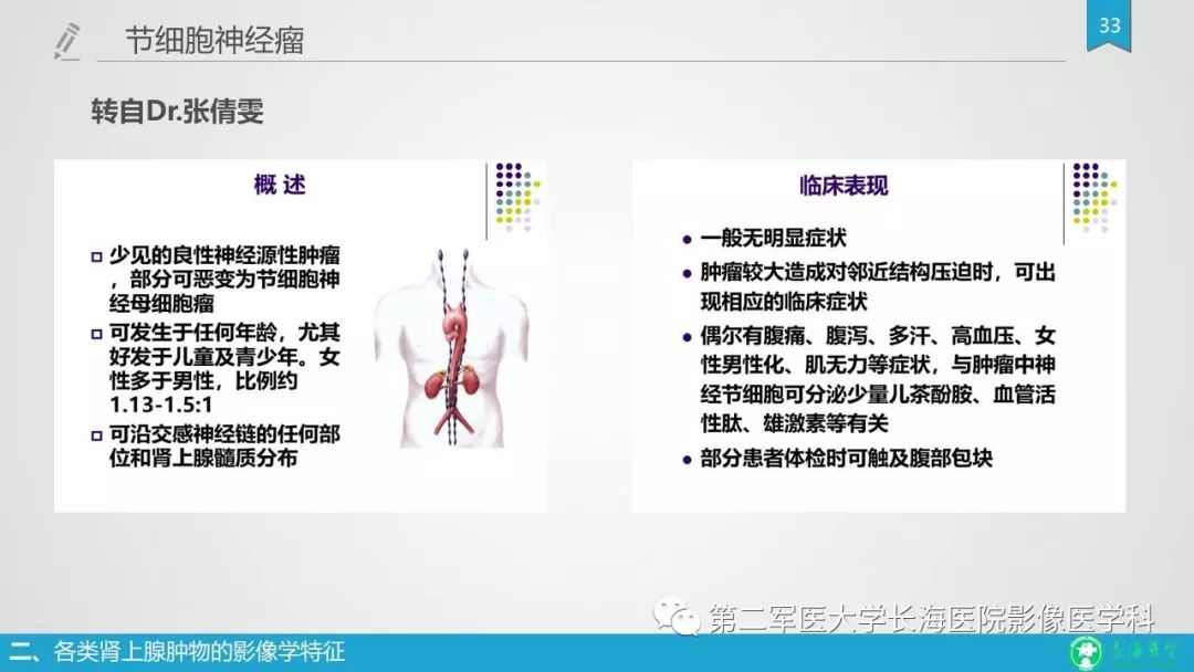 影像PPT - 【PPT】肾上腺肿物的分类及其影像学特点-33