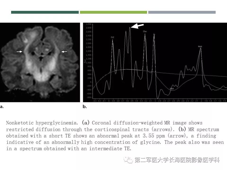 影像PPT - 【PPT】新生儿缺血缺氧性脑病的MR表现及相关解剖、生理基础-46