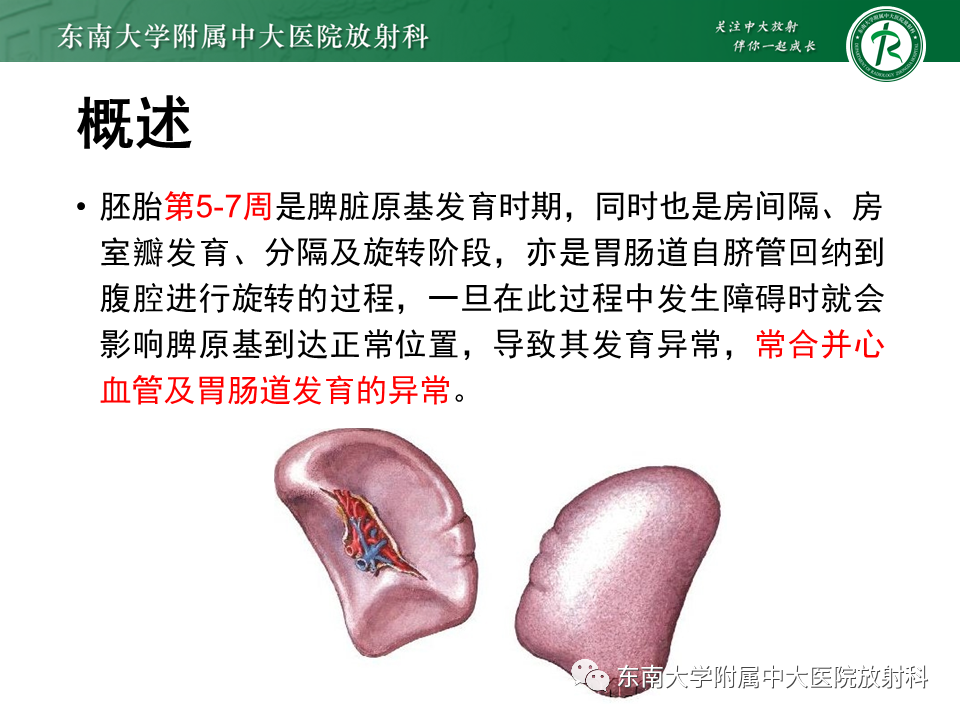 影像PPT - 【病例】多脾综合征1例CT影像-5