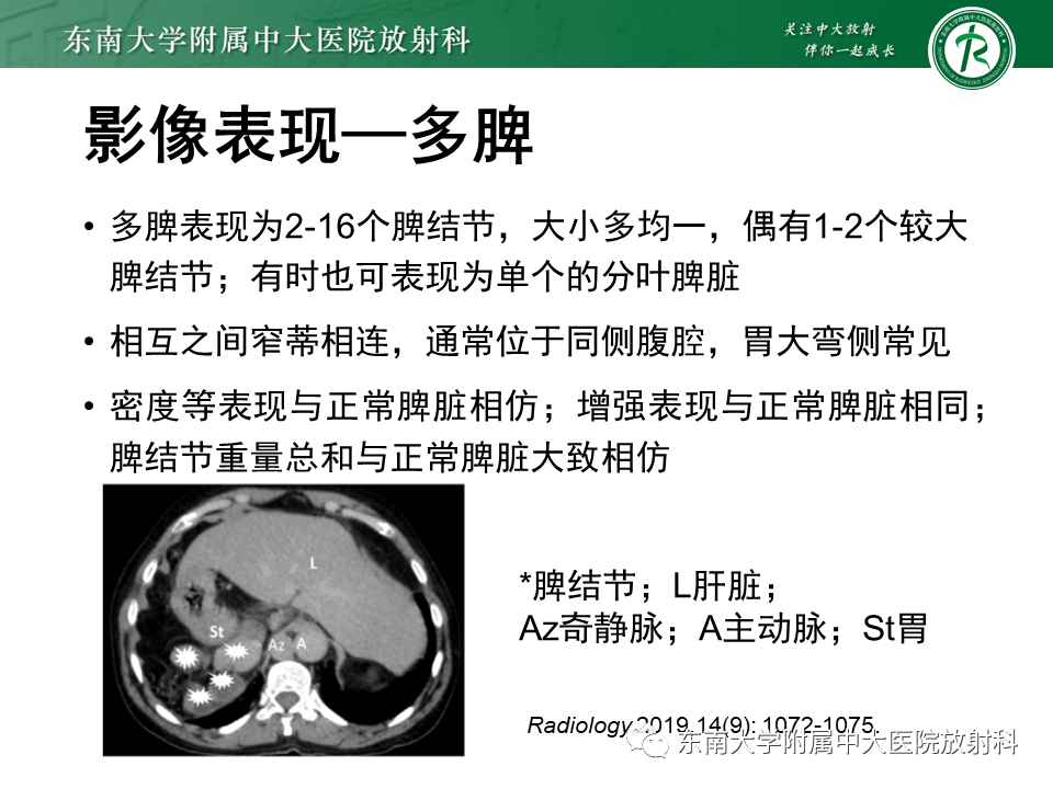影像PPT - 【病例】多脾综合征1例CT影像-8