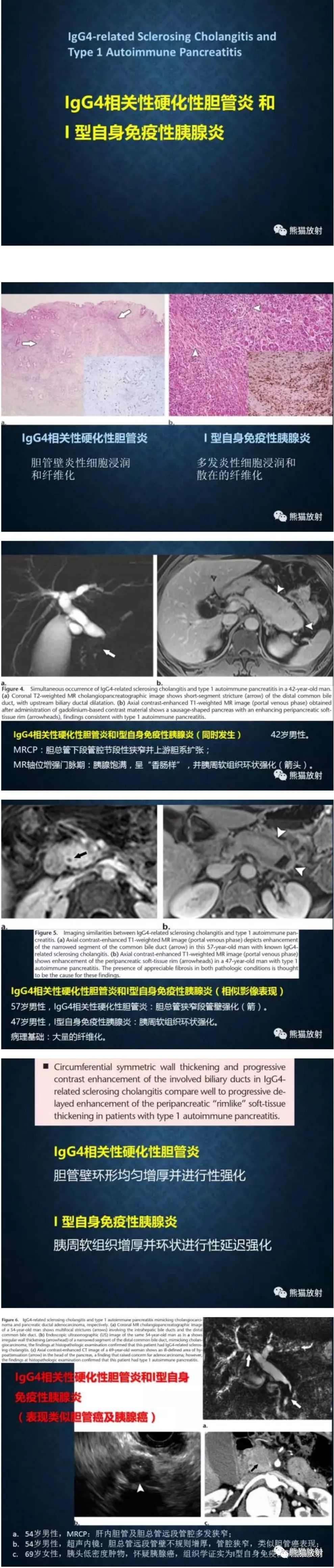 影像PPT - 【病例】自身免疫性胰腺炎1例MR影像-3 影像PPT - 【病例】自身免疫性胰腺炎1例MR影像-3