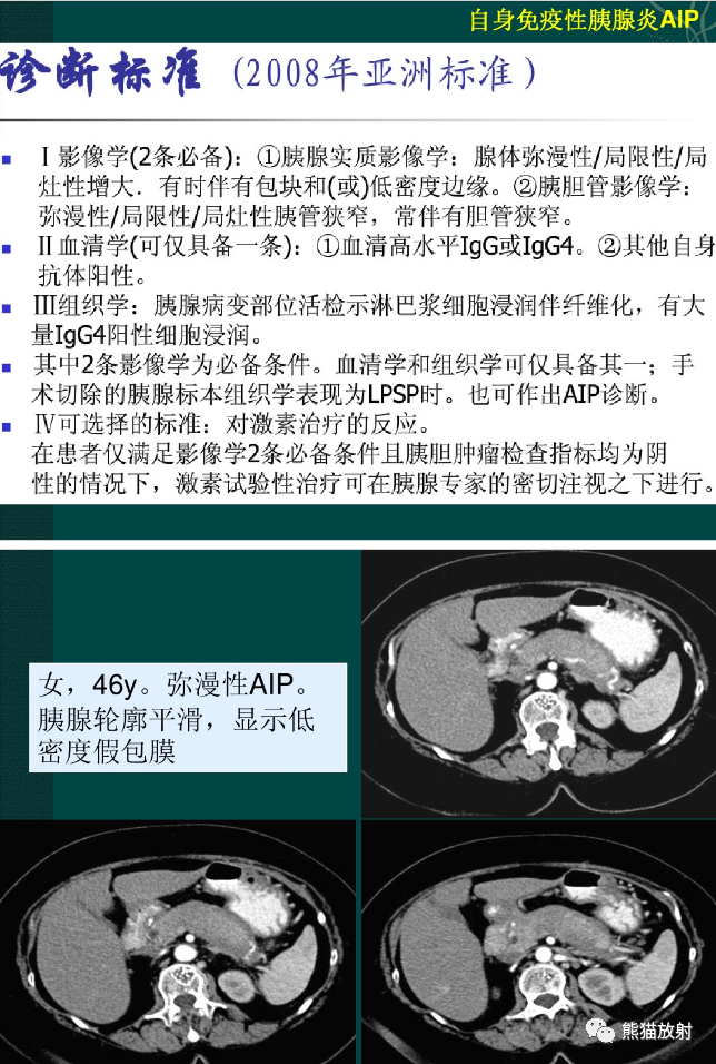 影像PPT - 【病例】自身免疫性胰腺炎1例MR影像-9 影像PPT - 【病例】自身免疫性胰腺炎1例MR影像-9