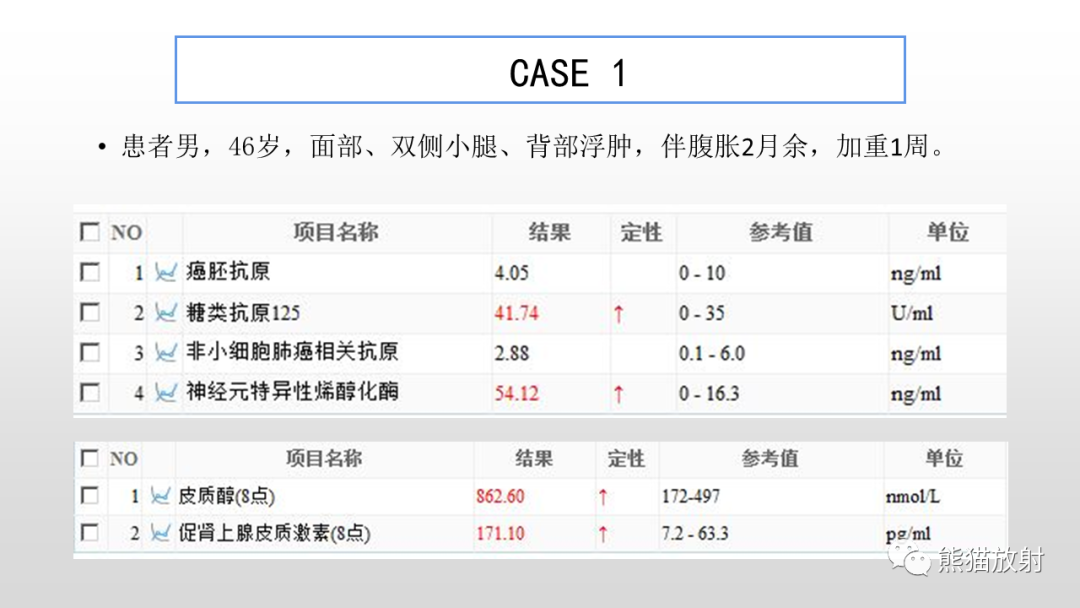影像PPT - 【病例】胸腺类癌2例CT影像-1
