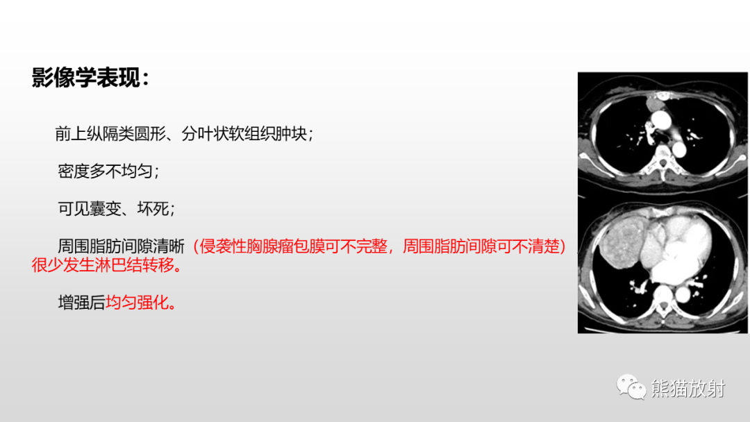 影像PPT - 【病例】胸腺类癌2例CT影像-24